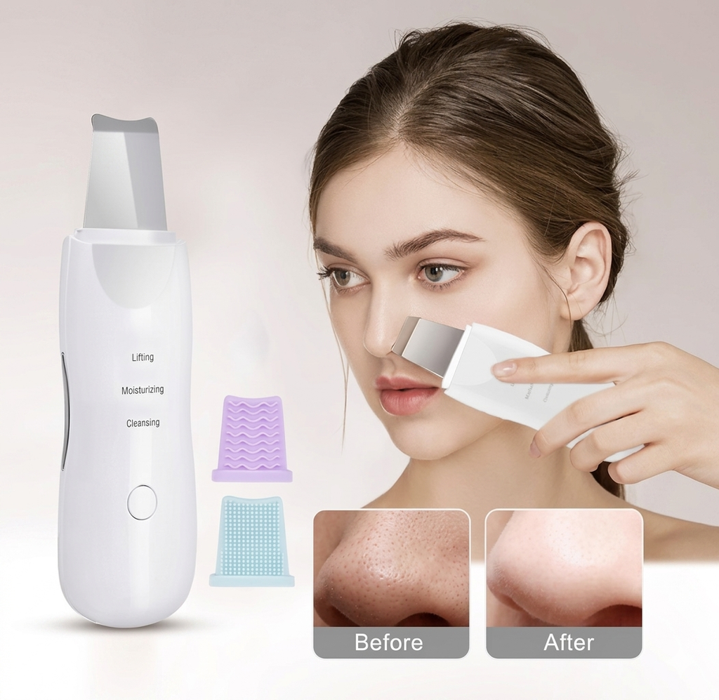 Electric Blackhead Pore Remover